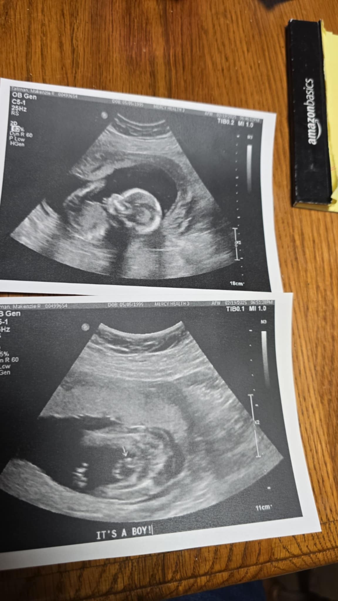 It's a boy